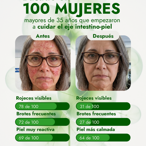 INTESTINO - PIEL