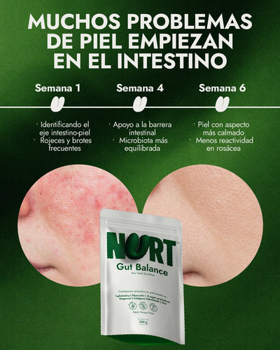 INTESTINO - PIEL